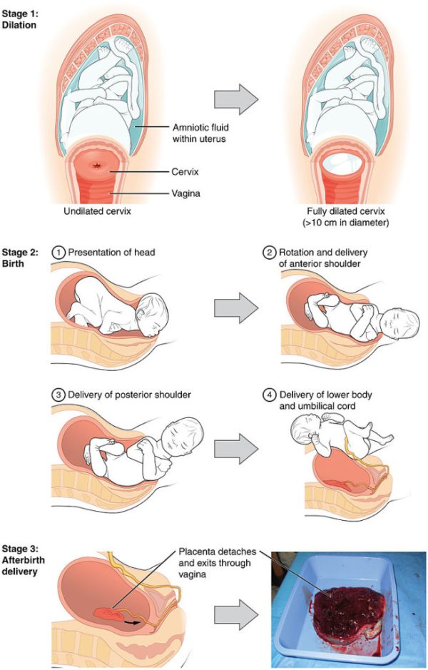 3-4-birth-and-delivery-mytext-cnm